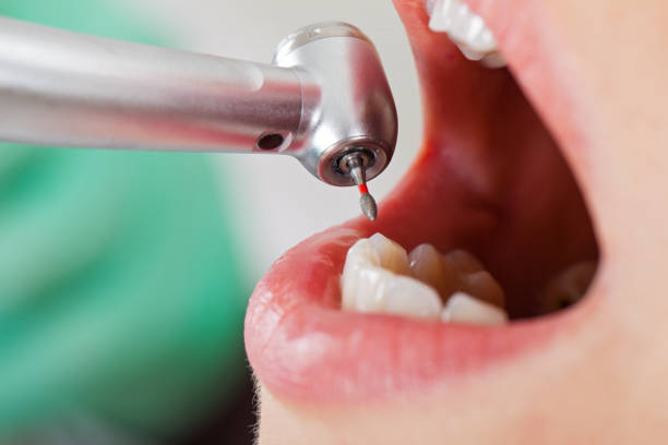 Best Emergency Treatment for Jaw Pain or Injury in Runaway Bay, TX